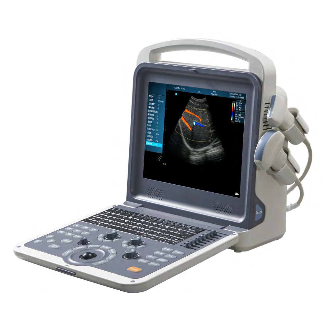 Portable Color Doppler Ultrasound System