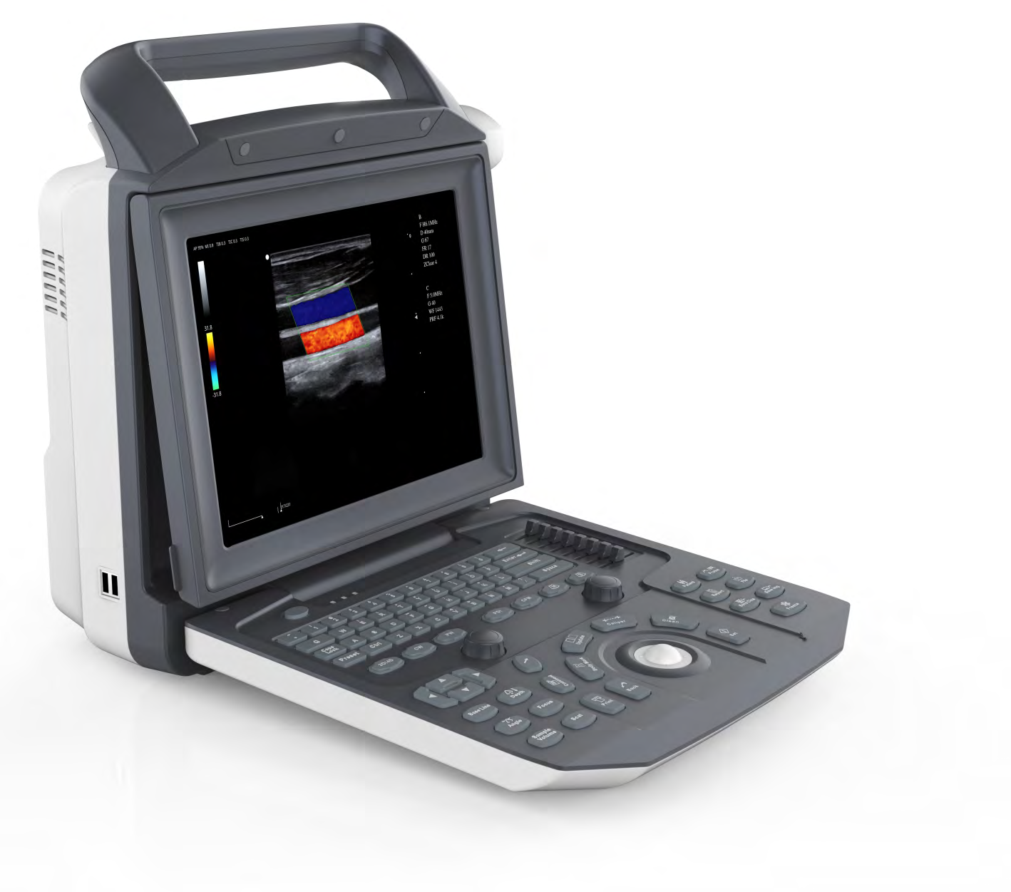 Portable Color Doppler Ultrasound System