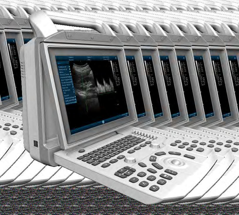 Wireless Ultrasound Probe